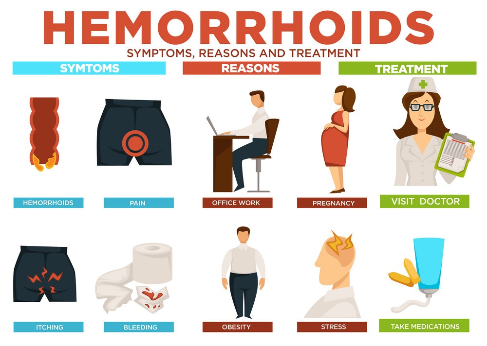 Piles Treatment Hemorrhoids Signcauses And Prevents Dr Husain Bohari 8743